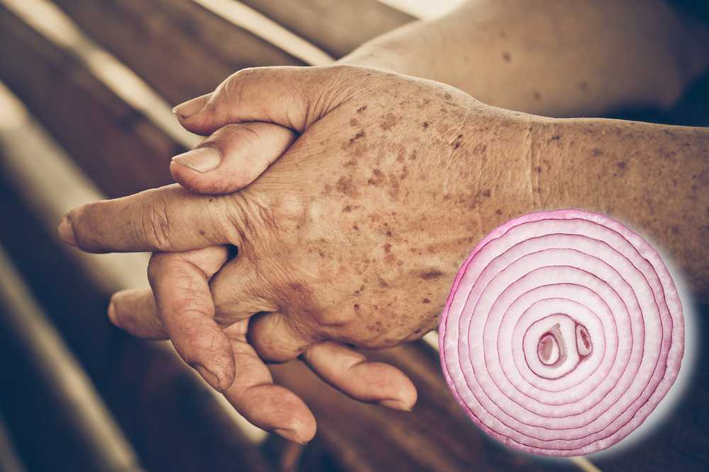 Do you have age spots on your skin? This simple trick can help you reduce them in no time!